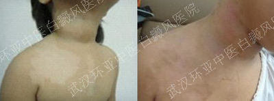 5׶粿ְװ߻񿵸